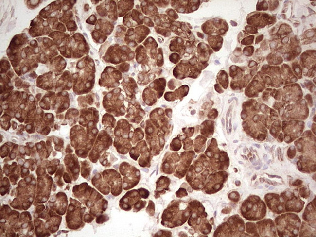 WIBG Antibody in Immunohistochemistry (Paraffin) (IHC (P))