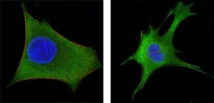 WNT1 Antibody in Immunocytochemistry (ICC/IF)