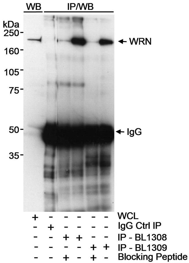 WRN Antibody in Western Blot (WB)