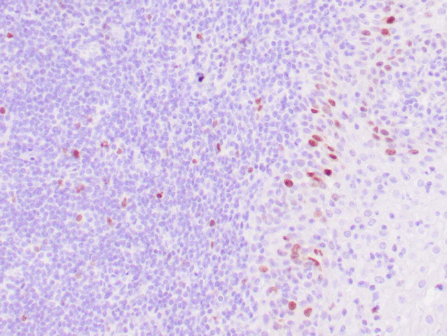 Thymidylate Synthase Antibody in Immunohistochemistry (Paraffin) (IHC (P))