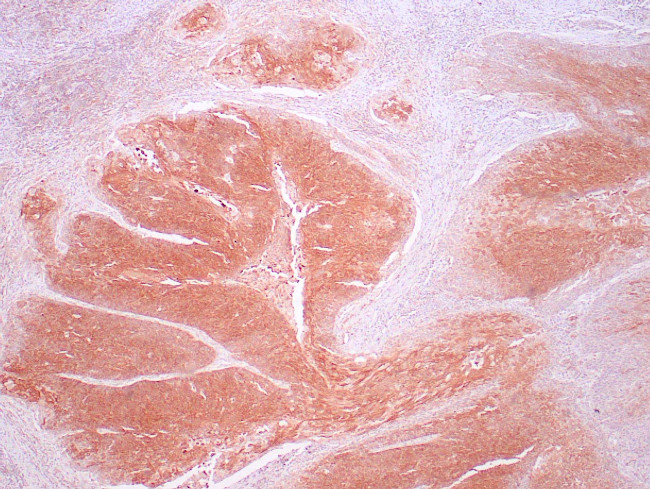 HPV Antibody in Immunohistochemistry (Paraffin) (IHC (P))