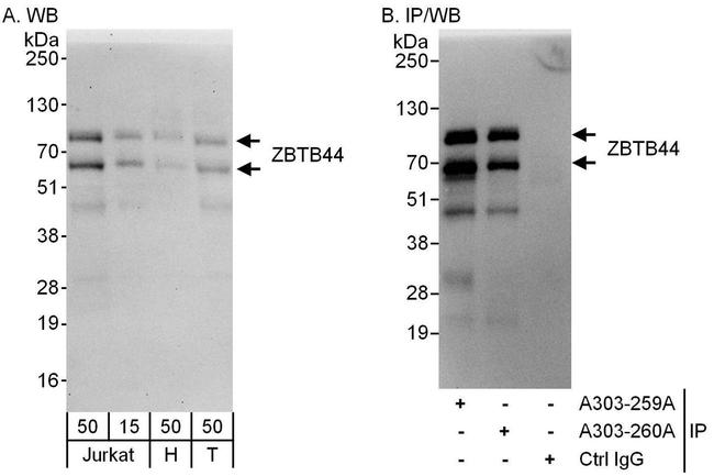 ZBTB44 Antibody in Western Blot (WB)