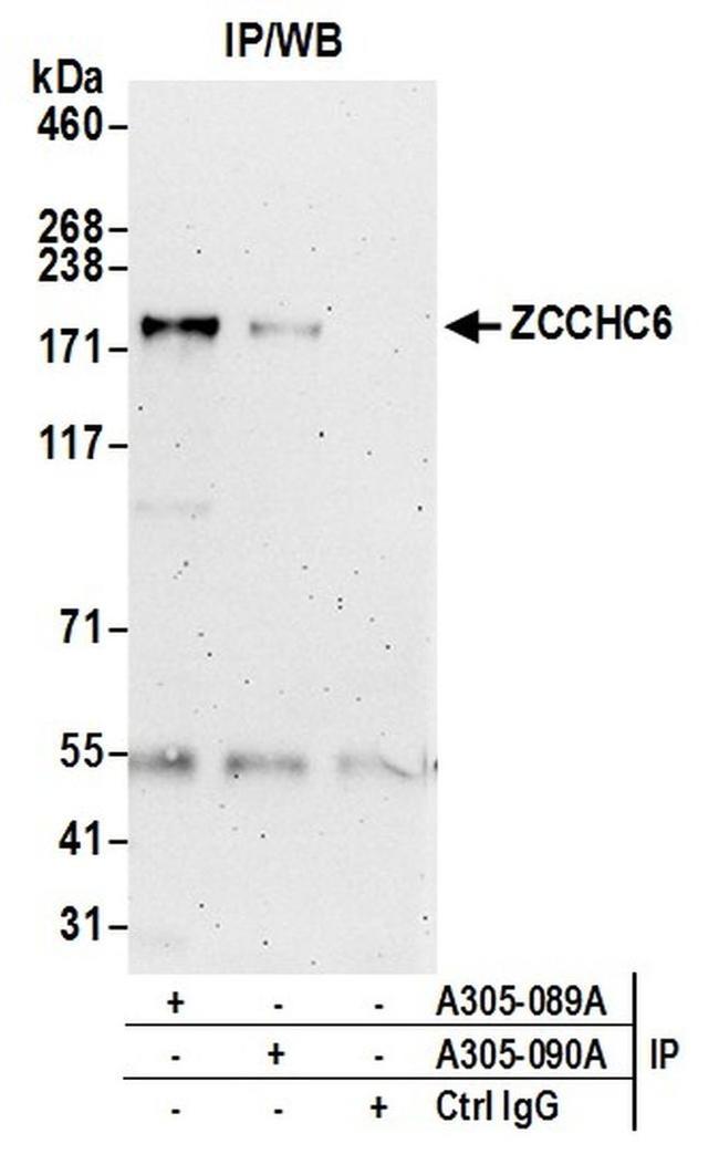 ZCCHC6 Antibody in Western Blot (WB)