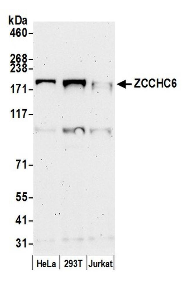 ZCCHC6 Antibody in Western Blot (WB)