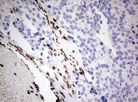 ZEB1 Antibody in Immunohistochemistry (Paraffin) (IHC (P))