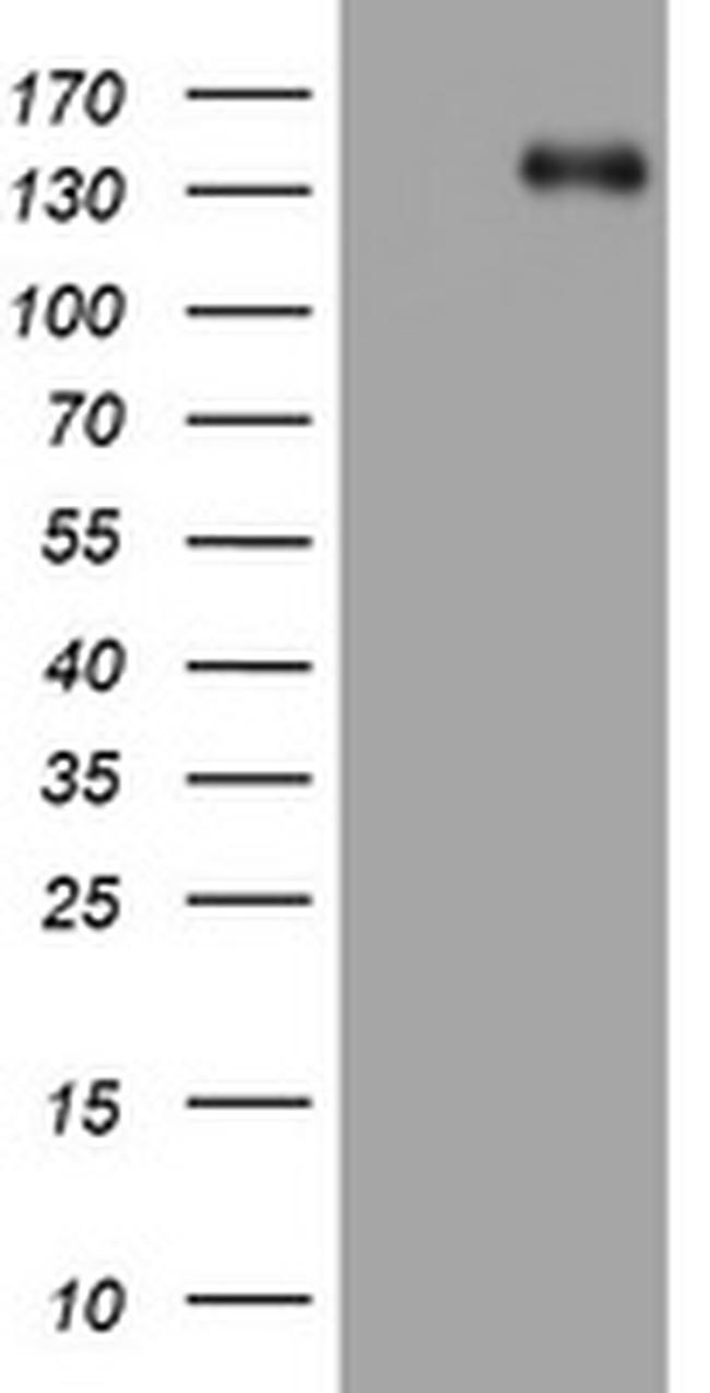 ZEB1 Antibody in Western Blot (WB)