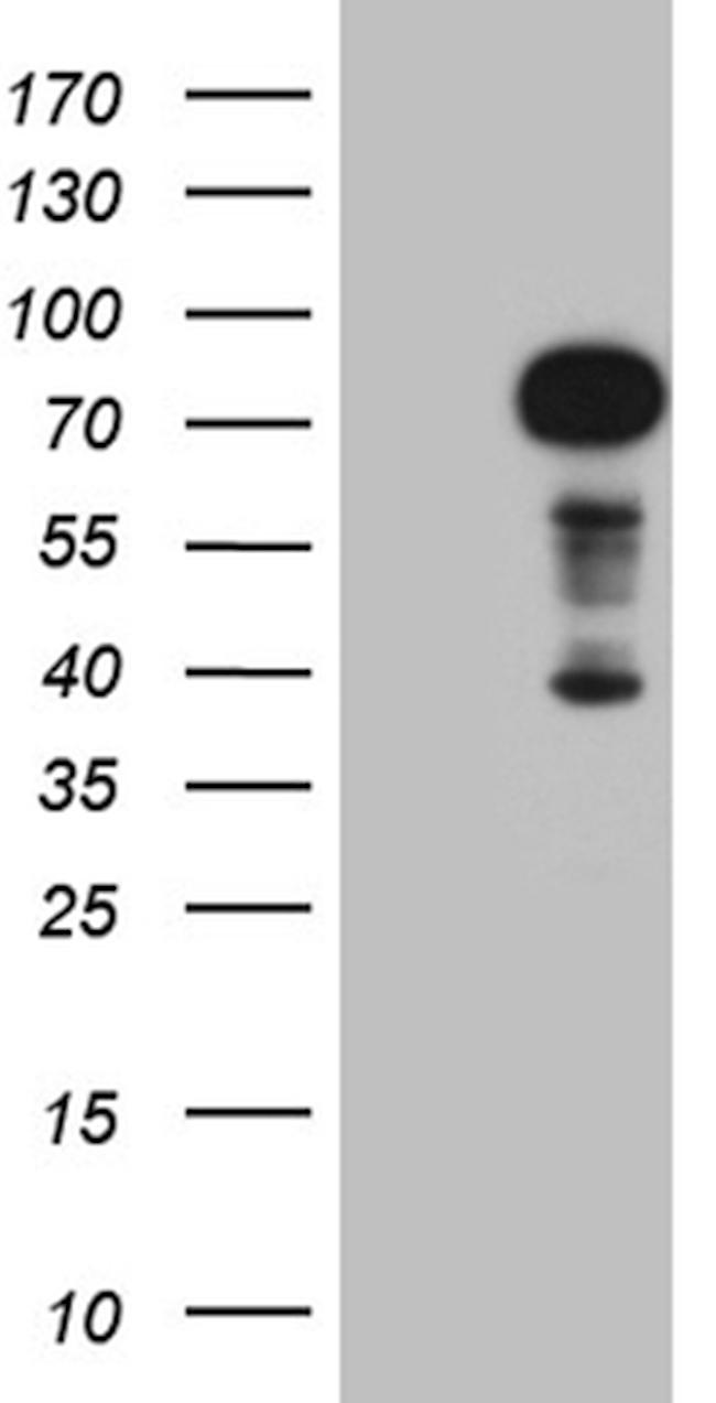 ZFP37 Antibody in Western Blot (WB)