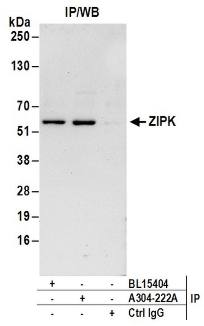 ZIPK Antibody in Immunoprecipitation (IP)