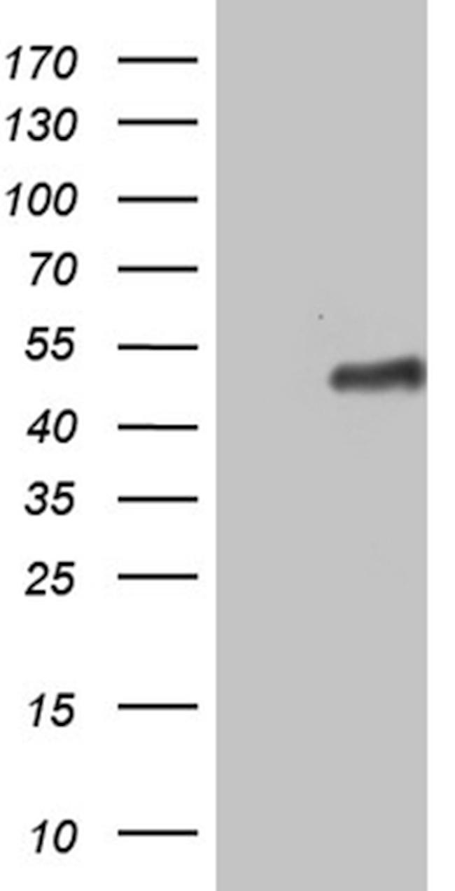 ZNF330 Antibody in Western Blot (WB)