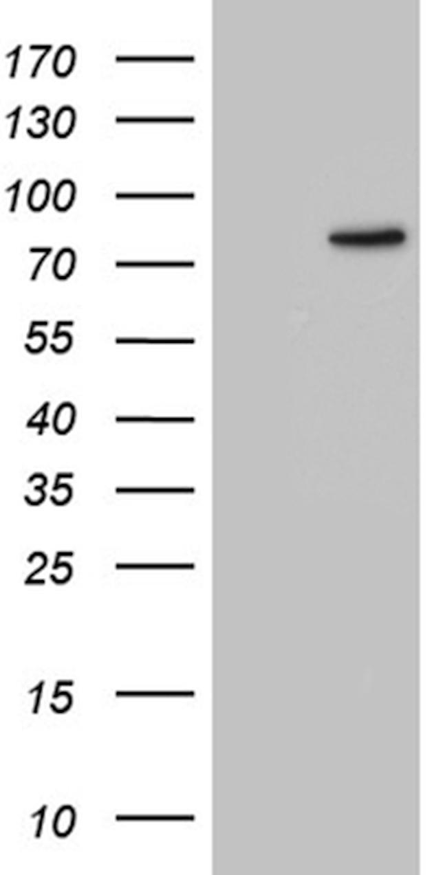 ZRANB1 Antibody in Western Blot (WB)