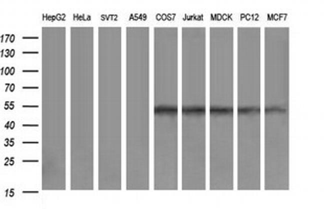 ZSCAN21 Antibody in Western Blot (WB)