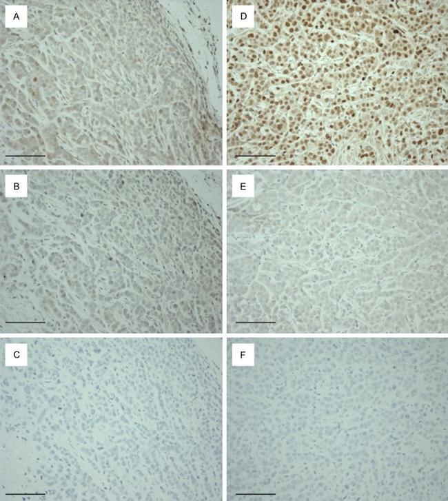 Estrogen Receptor beta Antibody in Immunohistochemistry (Paraffin) (IHC (P))
