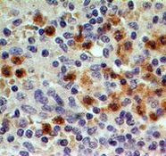 CCR1 Antibody in Immunohistochemistry (Paraffin) (IHC (P))