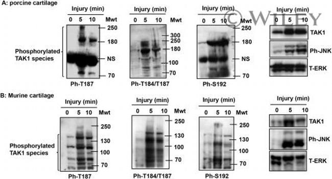 Phospho-JNK1/JNK2 (Thr183, Tyr185) Antibody in Western Blot (WB)