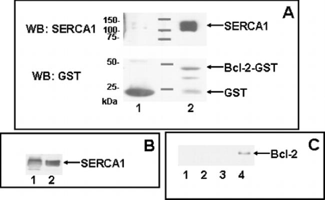 SERCA1 ATPase Antibody in Western Blot, Immunoprecipitation (WB, IP)