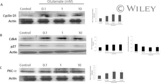 CDK4 Antibody in Western Blot (WB)