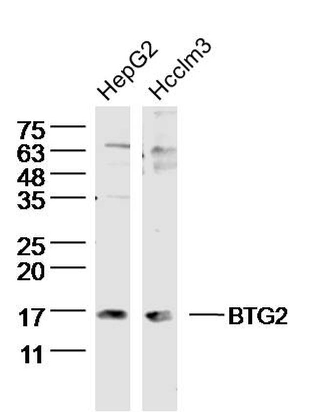 BTG2 Antibody in Western Blot (WB)