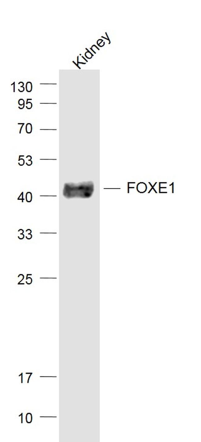 FOXE1 Antibody in Western Blot (WB)