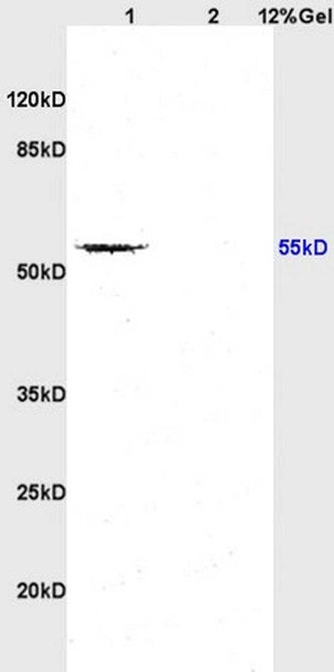 TGF Beta Receptor 1 Polyclonal Antibody (BS-0638R)