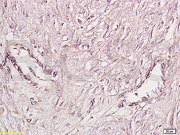 FGFR4/CD334 Antibody in Immunohistochemistry (Paraffin) (IHC (P))