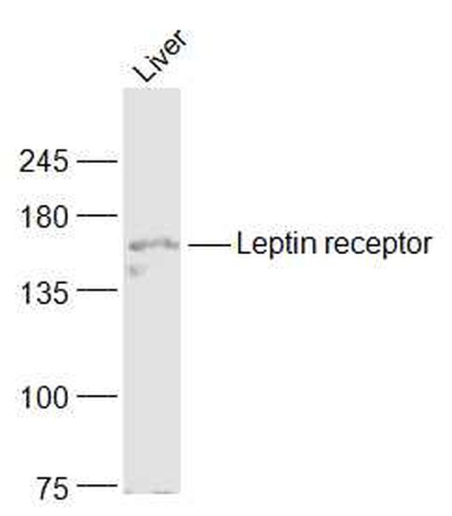 Leptin receptor Antibody in Western Blot (WB)