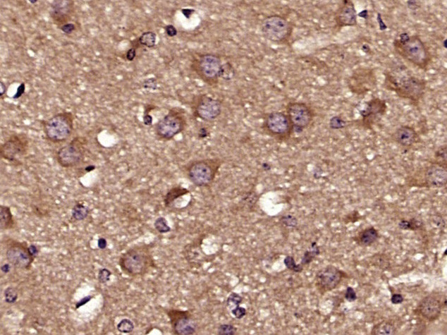 Phospho-Tau protein (Ser579) Antibody in Immunohistochemistry (Paraffin) (IHC (P))