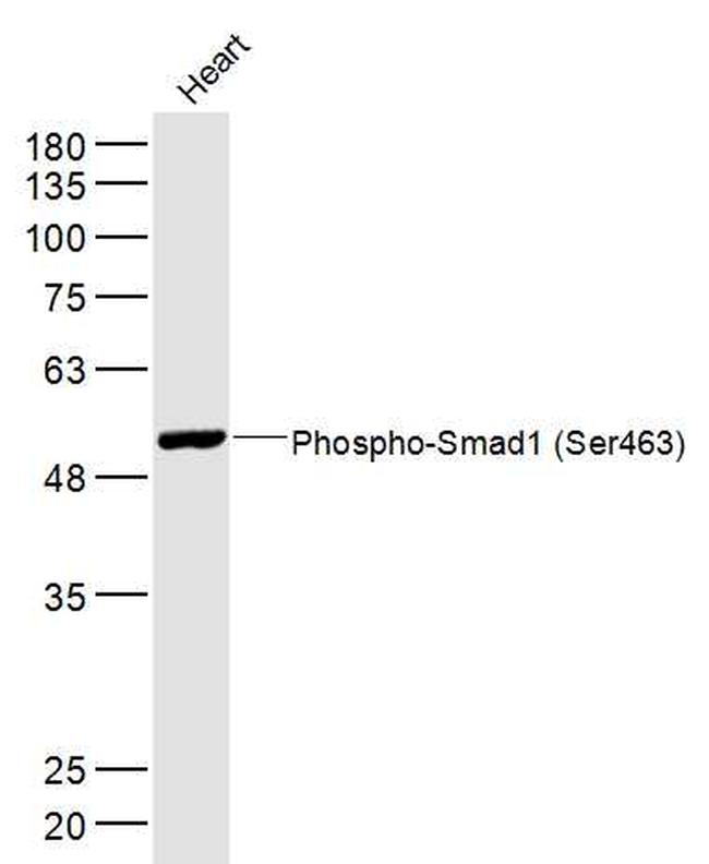 Phospho-Smad1 (Ser463) Antibody in Western Blot (WB)
