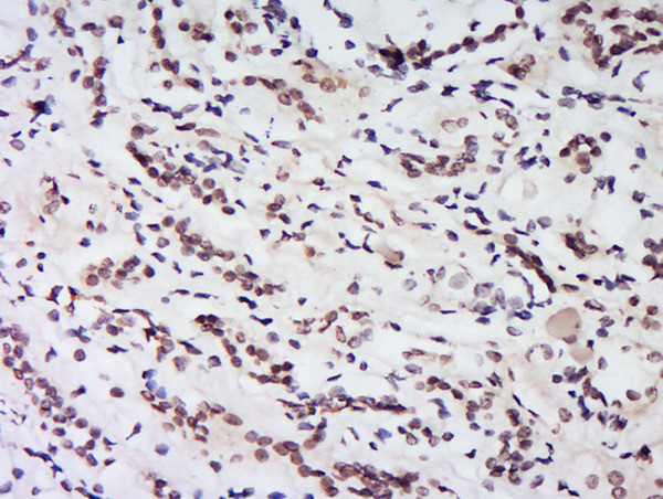 HS1BP3 Antibody in Immunohistochemistry (Paraffin) (IHC (P))