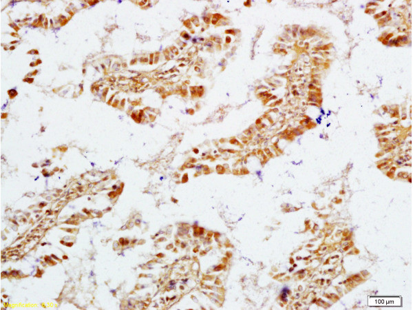 ECE1 Antibody in Immunohistochemistry (Paraffin) (IHC (P))