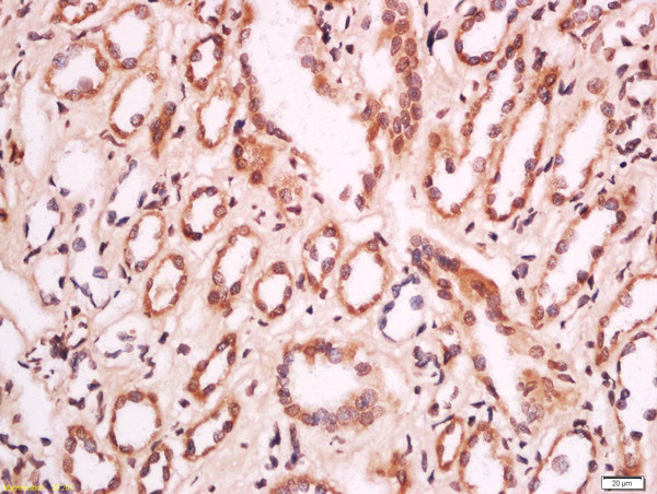 MELK/HPK38 Antibody in Immunohistochemistry (Paraffin) (IHC (P))