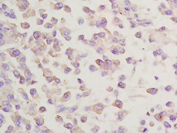 GGA2 Antibody in Immunohistochemistry (Paraffin) (IHC (P))