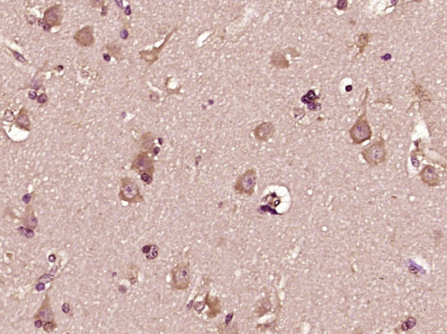 DHI1L Antibody in Immunohistochemistry (Paraffin) (IHC (P))