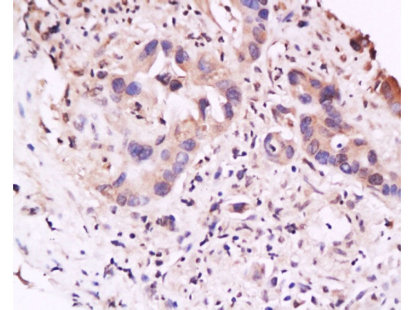 IL-23R Antibody in Immunohistochemistry (Paraffin) (IHC (P))