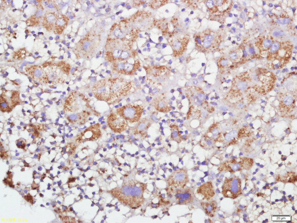 GRP75 Antibody in Immunohistochemistry (Paraffin) (IHC (P))