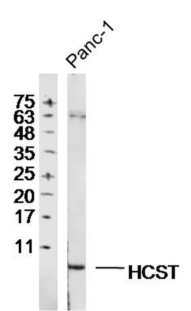 HCST Antibody in Western Blot (WB)