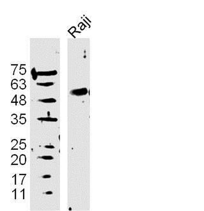 DAPK3 Antibody in Western Blot (WB)