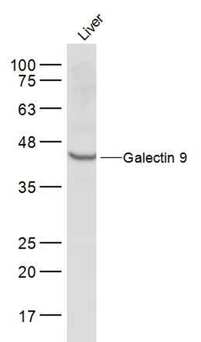 Galectin 9 Antibody in Western Blot (WB)