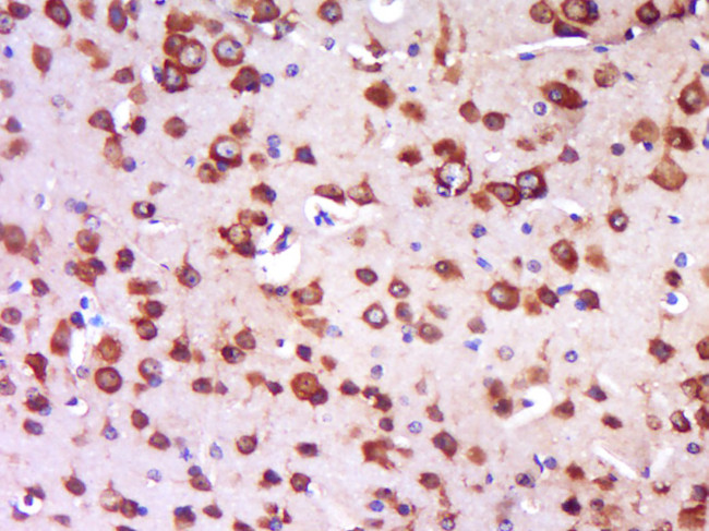 TRIT1 Antibody in Immunohistochemistry (Paraffin) (IHC (P))