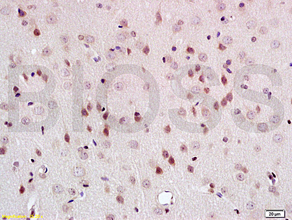 PEG3 Antibody in Immunohistochemistry (Paraffin) (IHC (P))