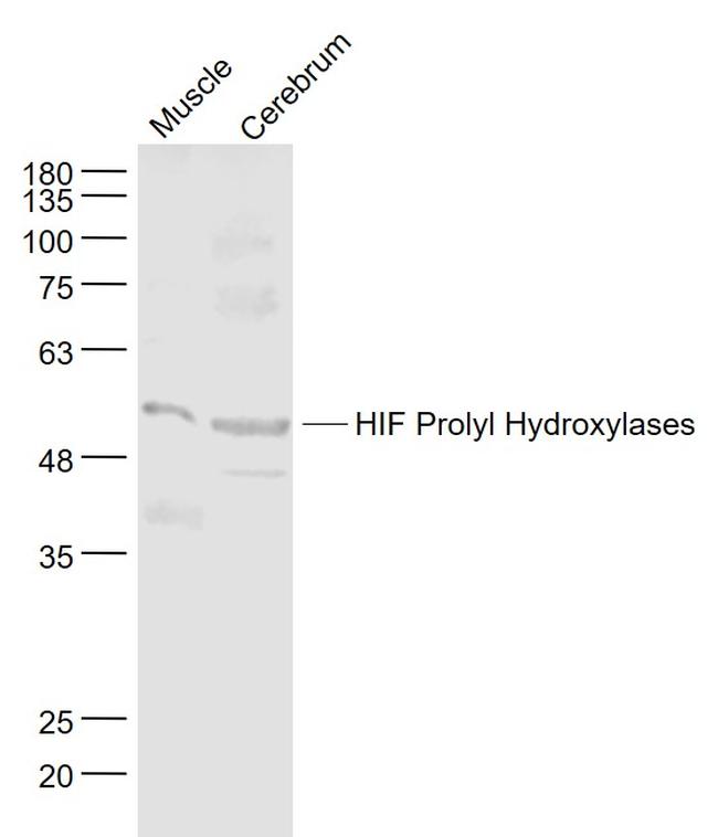 P4HTM Antibody in Western Blot (WB)