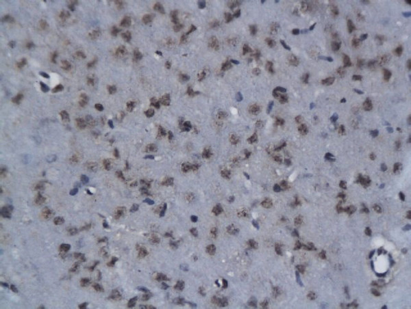 NIT2 Antibody in Immunohistochemistry (Paraffin) (IHC (P))