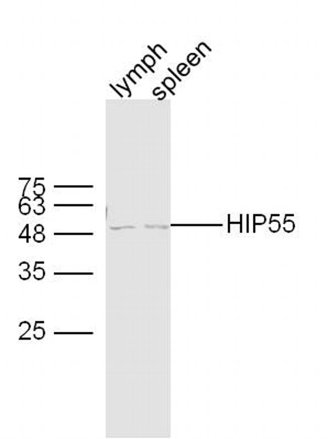 HIP55 Antibody in Western Blot (WB)