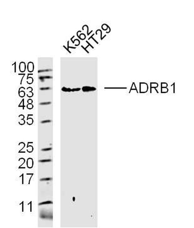 ADRB1 Antibody in Western Blot (WB)