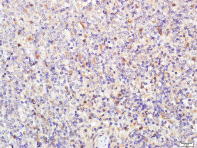 Neurogenic locus notch homolog protein 1 Antibody in Immunohistochemistry (Paraffin) (IHC (P))