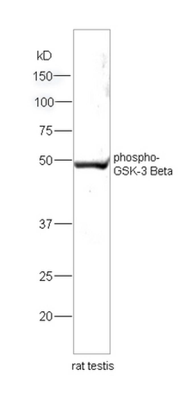 Phospho-GSK-3 Beta (Ser9) Polyclonal Antibody (BS-2066R)