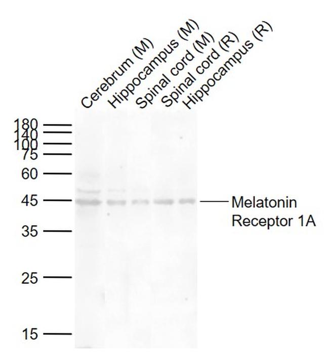 Melatonin Receptor 1A Antibody in Western Blot (WB)