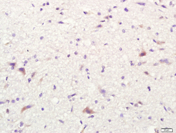 CD80 Antibody in Immunohistochemistry (Paraffin) (IHC (P))