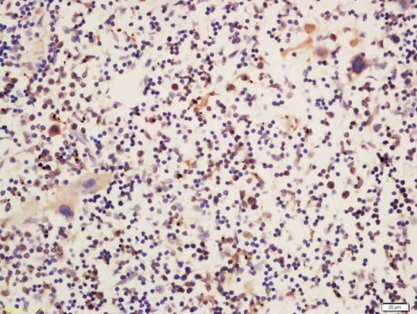 Phospho-Btk (Ser180) Antibody in Immunohistochemistry (Paraffin) (IHC (P))