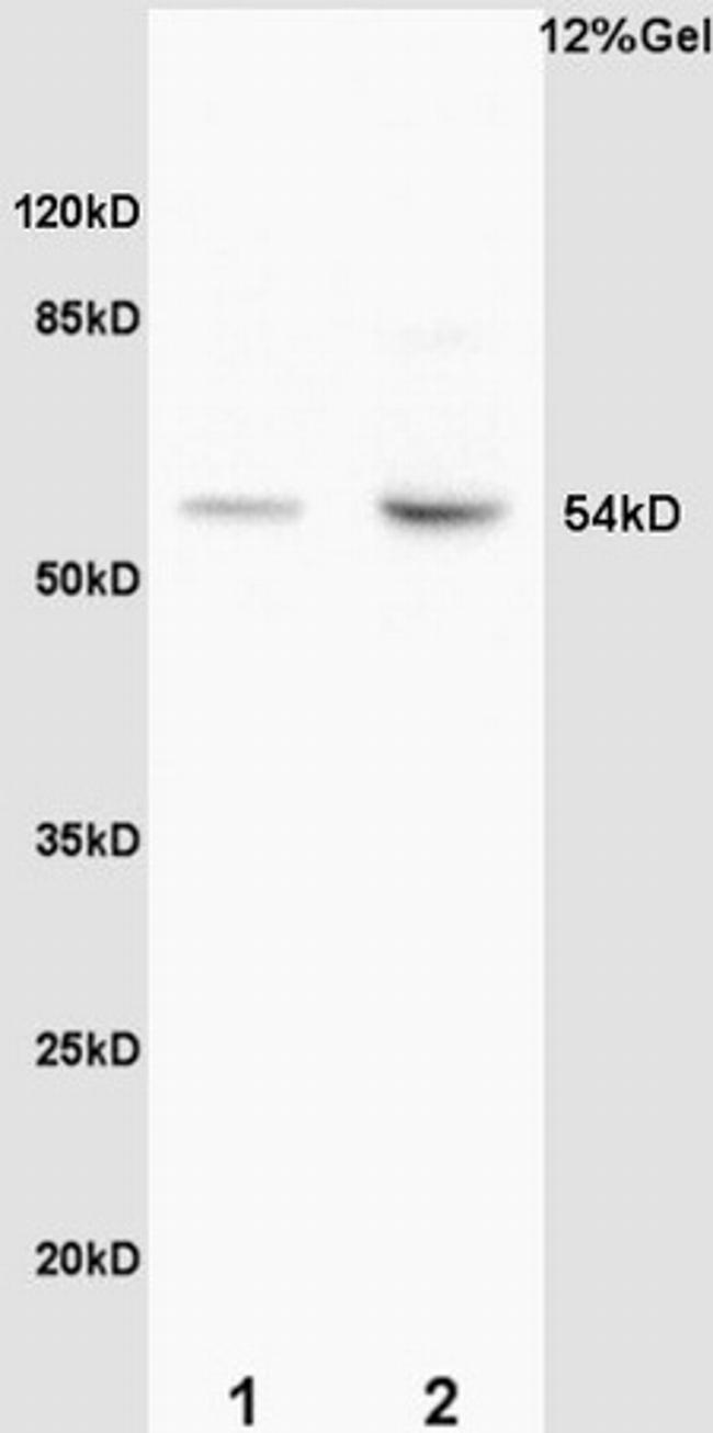 Phospho-MEF2A (Thr312) Antibody in Western Blot (WB)
