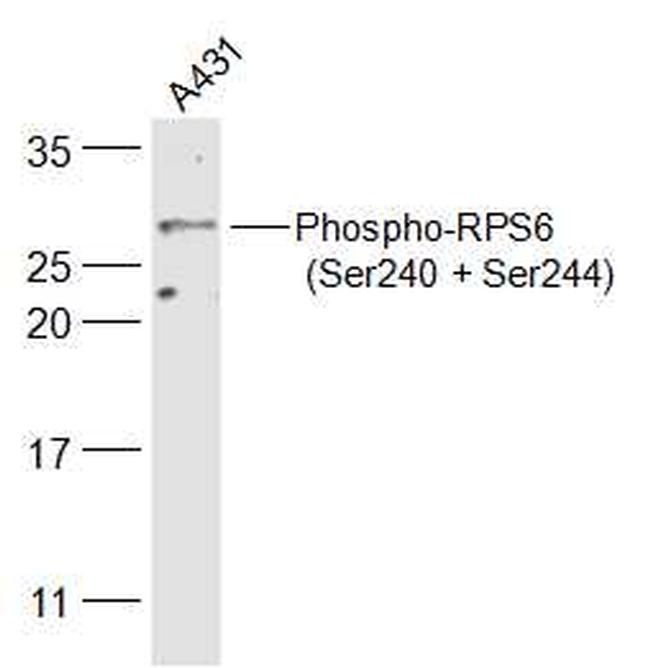 Phospho Rps6 Ser240 Ser244 Polyclonal Antibody Bs 3389r 1461